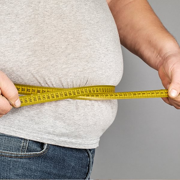 Obesity